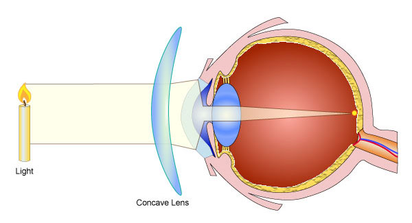 eye-lens